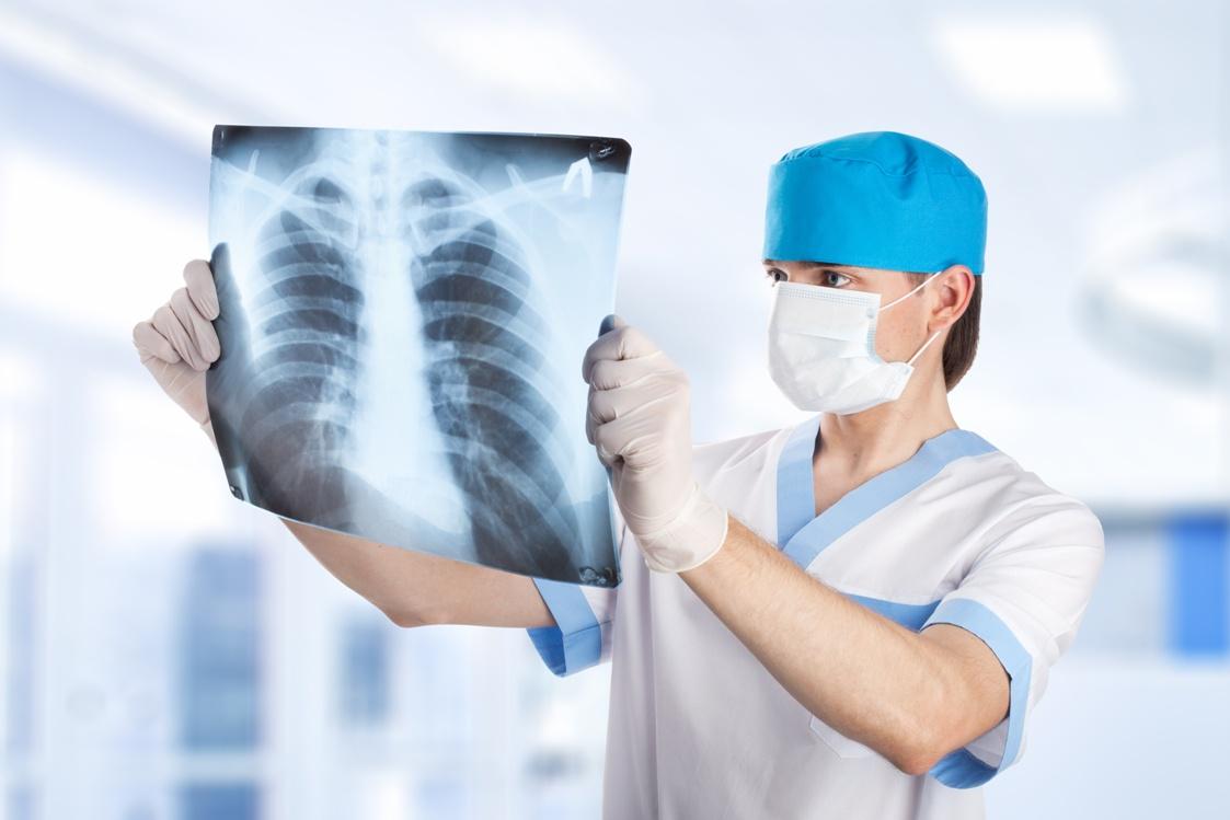 Number of tuberculosis patients decreased in Azerbaijan