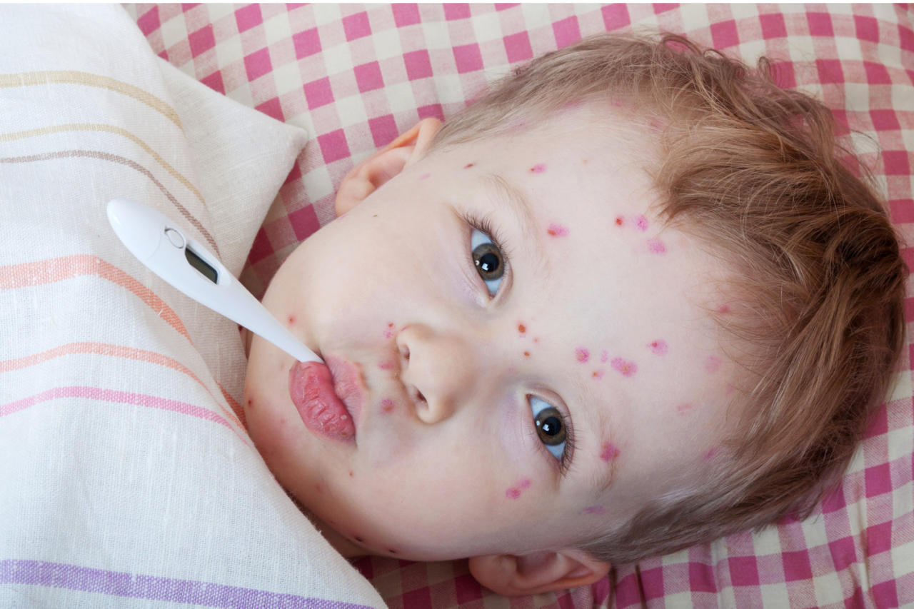 Will Azerbaijan offer chickenpox vaccinations?