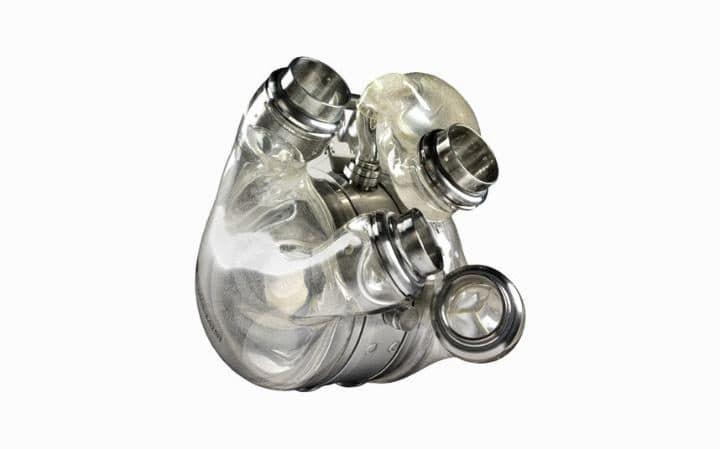Artificial heart transplantation carried out for the first time in Azerbaijan