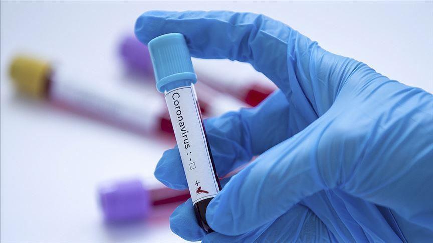 TABIB: Azerbaijan discloses number of coronavirus tests per 1 million people