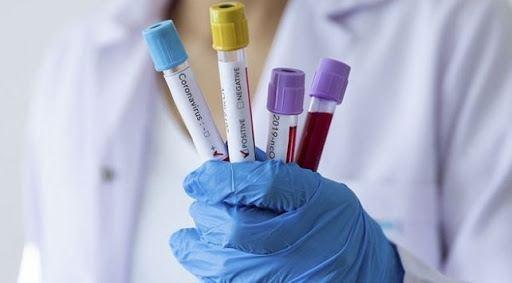 Kyrgyzstan reports 74 new COVID-19 cases