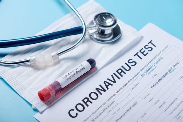TABIB: Decision on quarantine can be made based on results of serologic tests