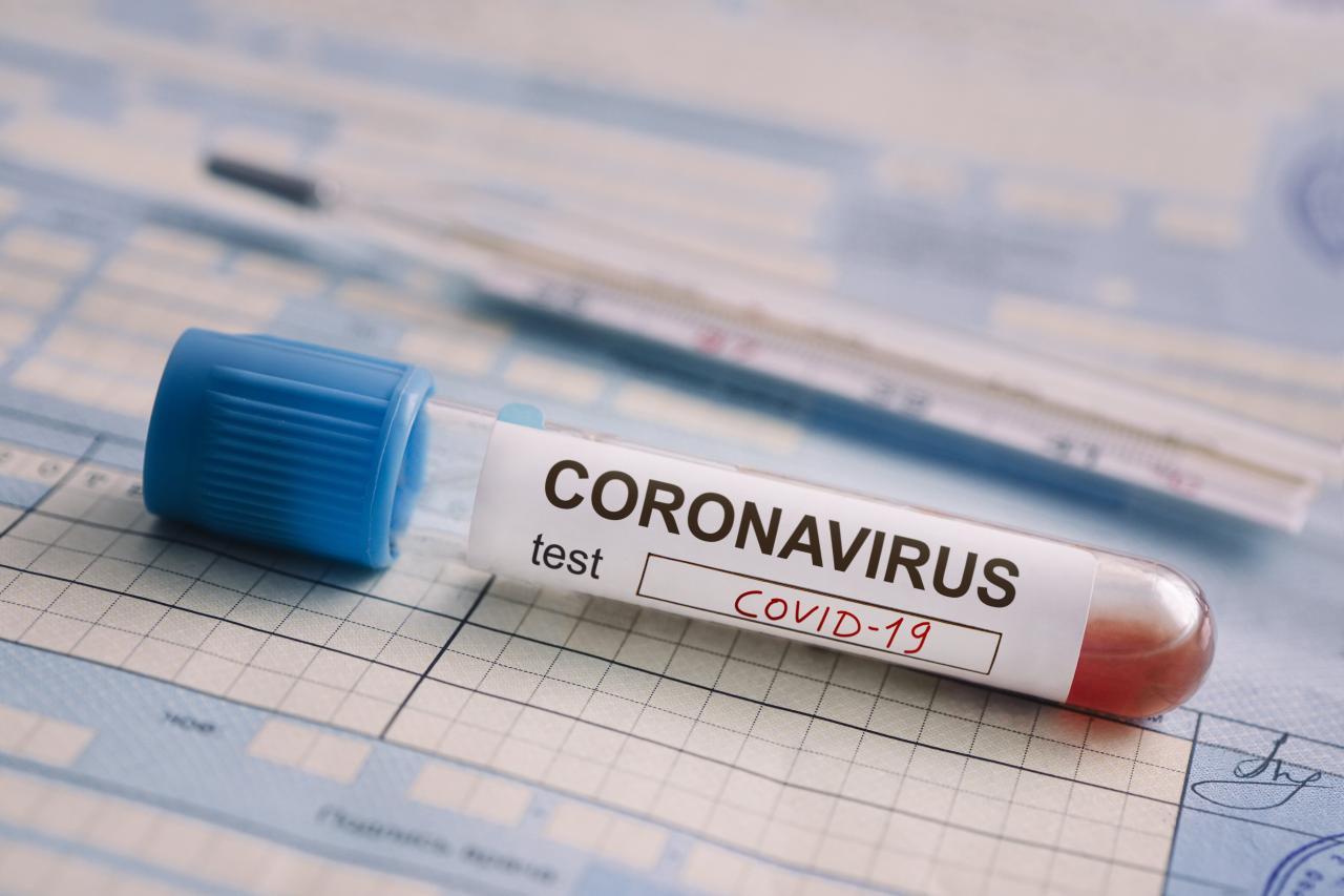 Baku accounts for largest number of COVID19 cases in Azerbaijan