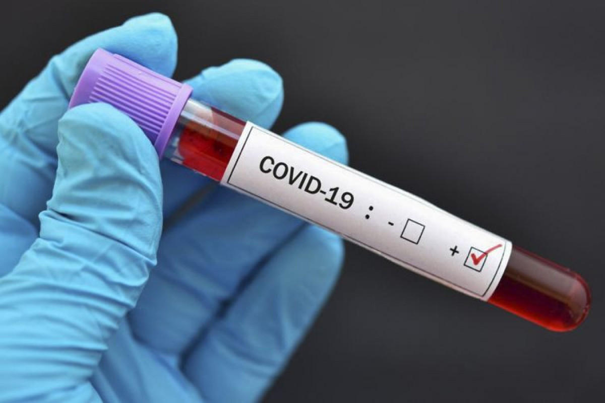 Kazakhstan confirms  over 400 new COVID-19 cases