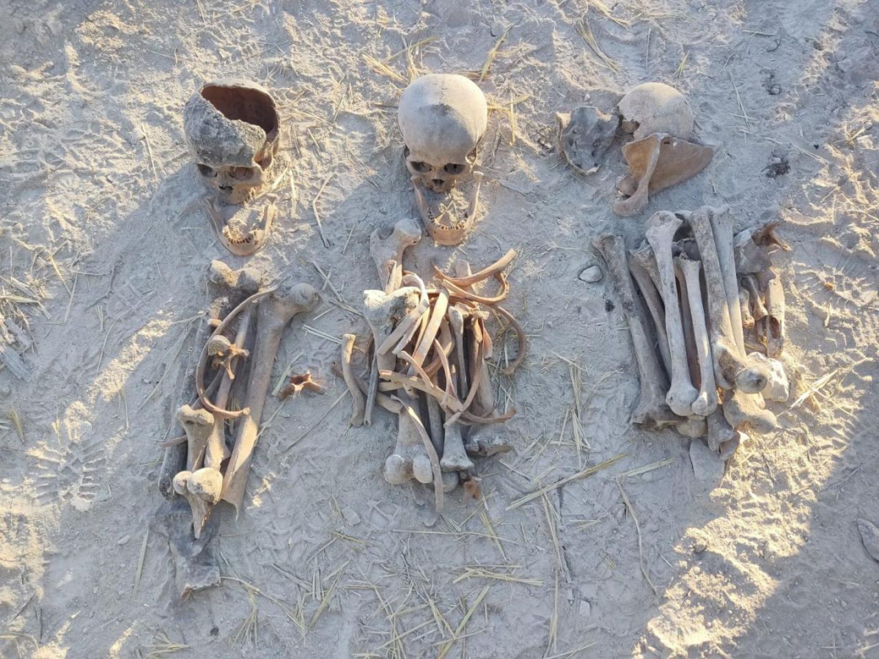 Newly-found human remains attest to Armenian atrocities in Karabakh [PHOTO]