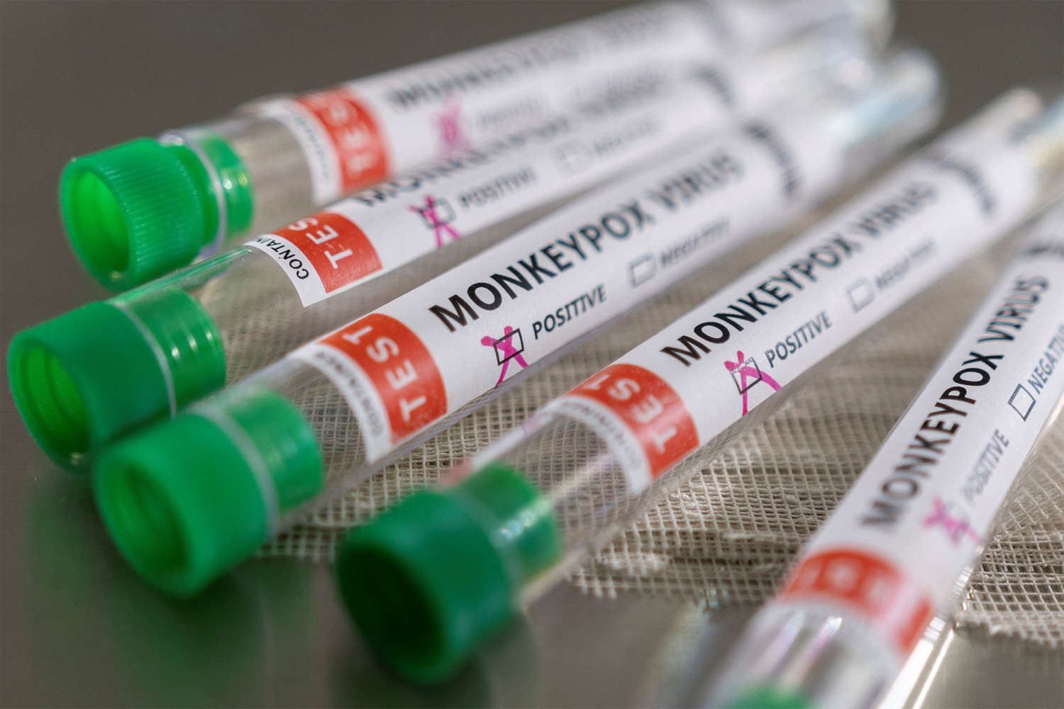 U.S. has world's biggest monkeypox outbreak