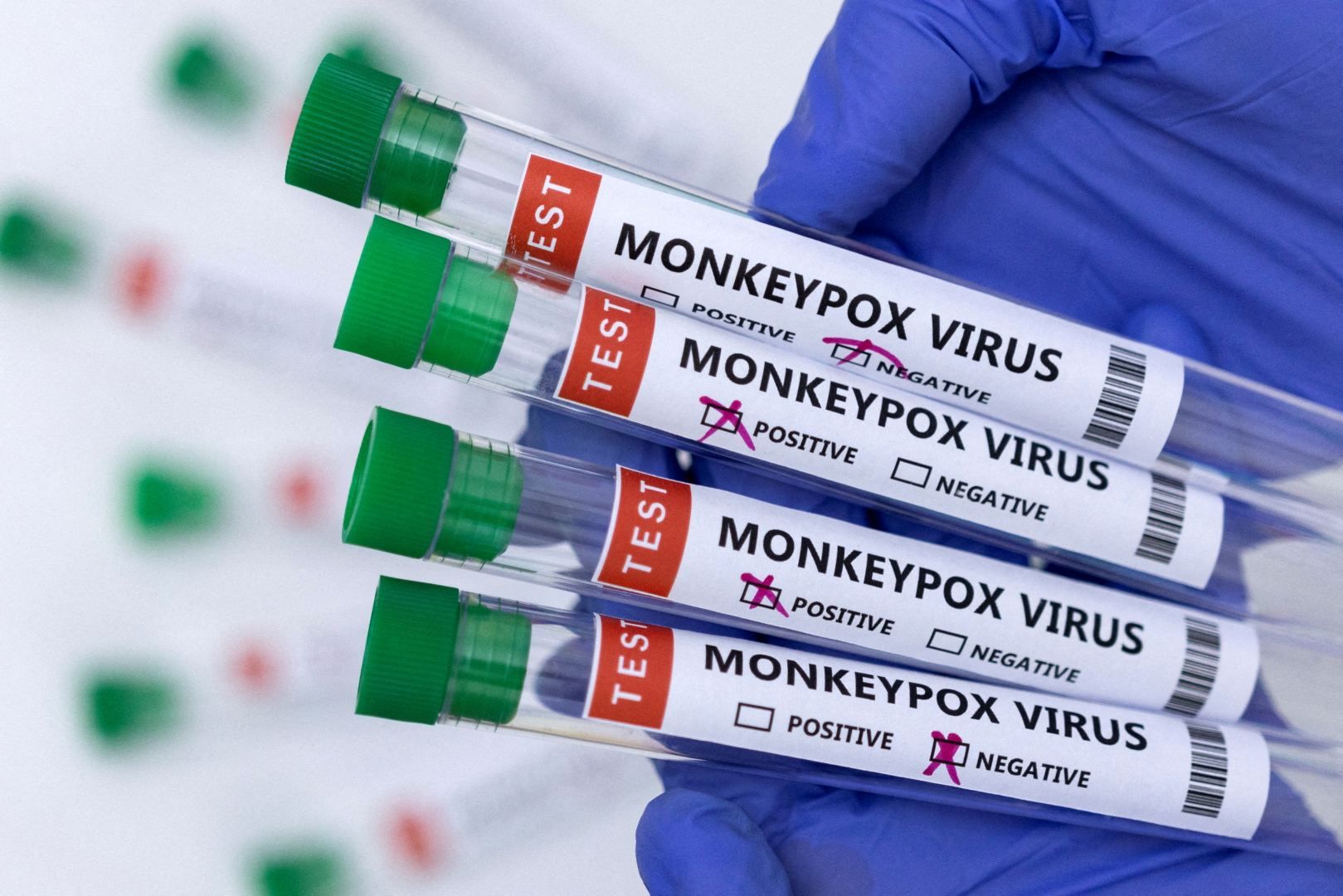 Iran reports 1st monkeypox case
