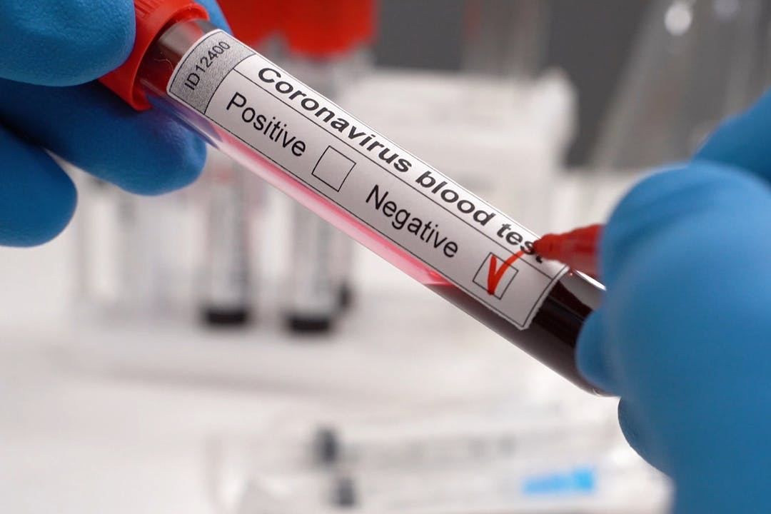 UK scraps COVID-19 tests for asymptomatic as cases continue to fall