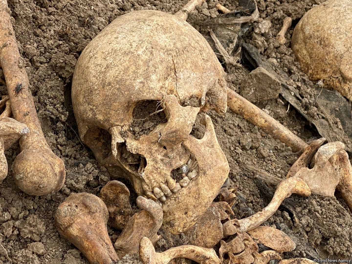 Another mass grave of Azerbaijani servicemen found in Karabakh [PHOTO] - Gallery Image