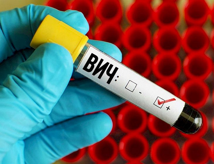 12,779 HIV cases registered in Kyrgyzstan