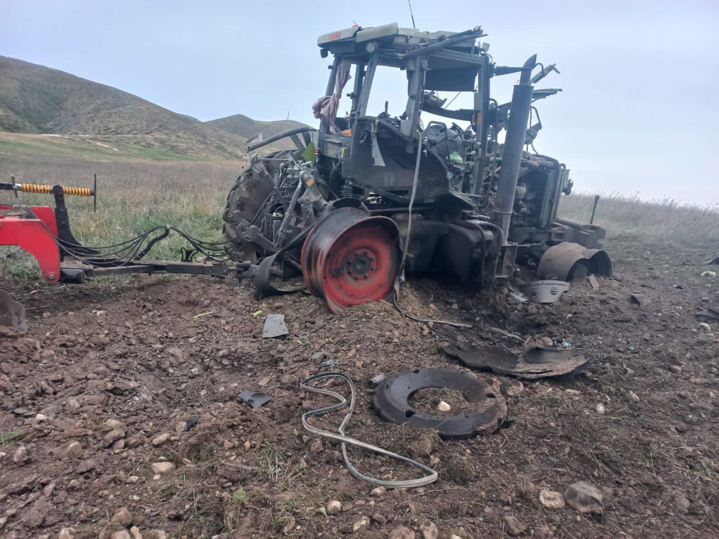 Azerbaijani citizen steps on landmine