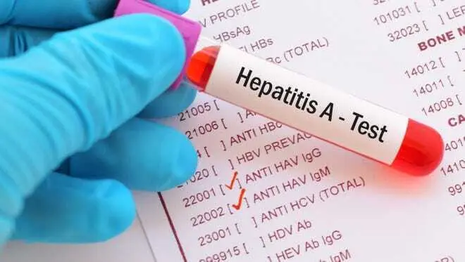 Azerbaijan's Health Ministry releases information on cases of hepatitis A infection