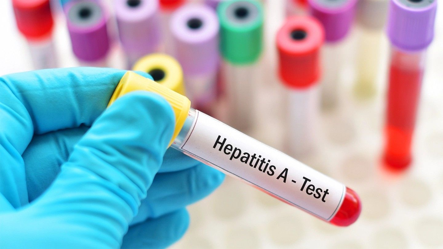 Azerbaijani health specialist warns public about Hepatitis A