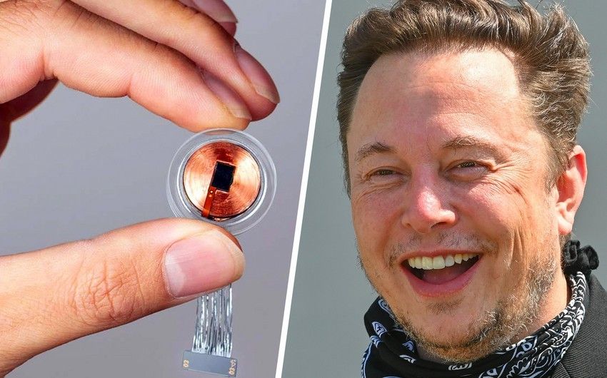 Elon Musk's company implants  first implant in human brain