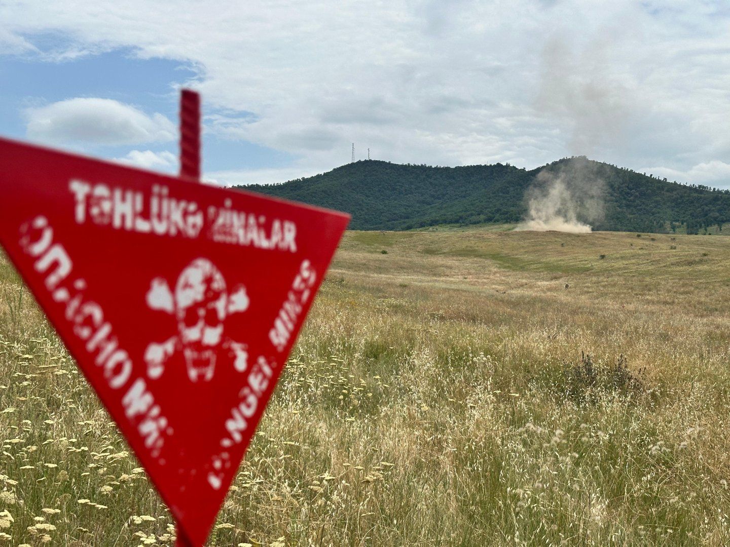 Aghdam land-mine incident leaves civilian hospitalized after surgery