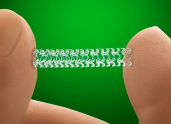 First absorb heart stent implantation in Azerbaijan
