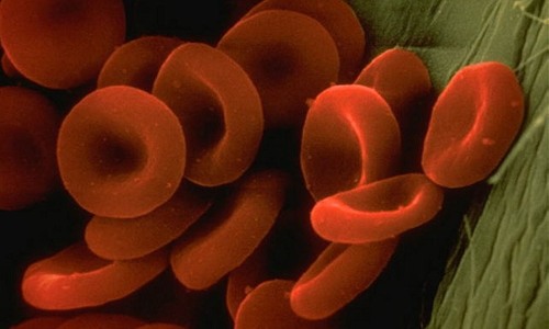 State further backs people with hemophilia, thalassemia
